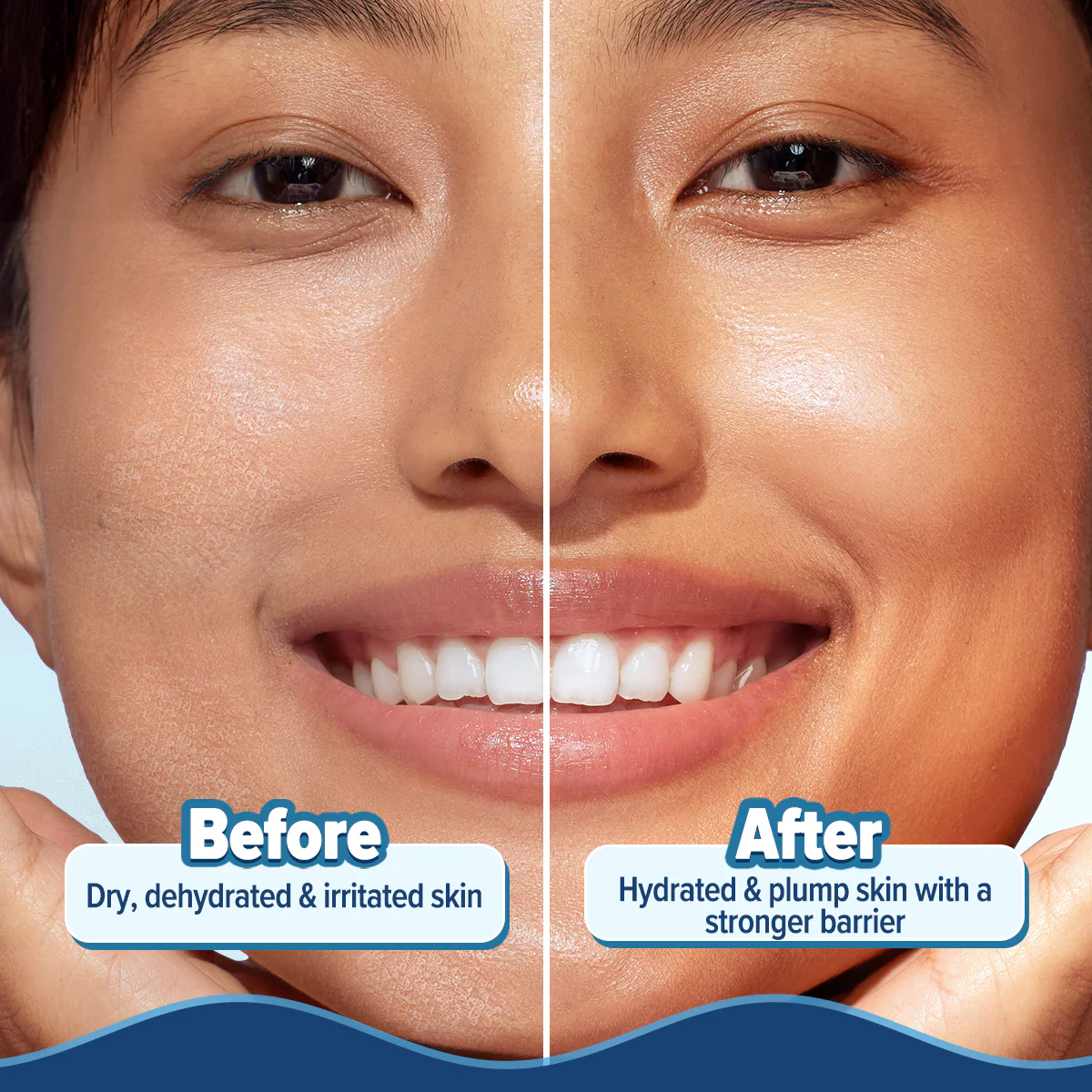 5 Barrier+ Hydra Gel Moisturizer with Avocado & 5 Essential Ceramides - 100 g - Image 7