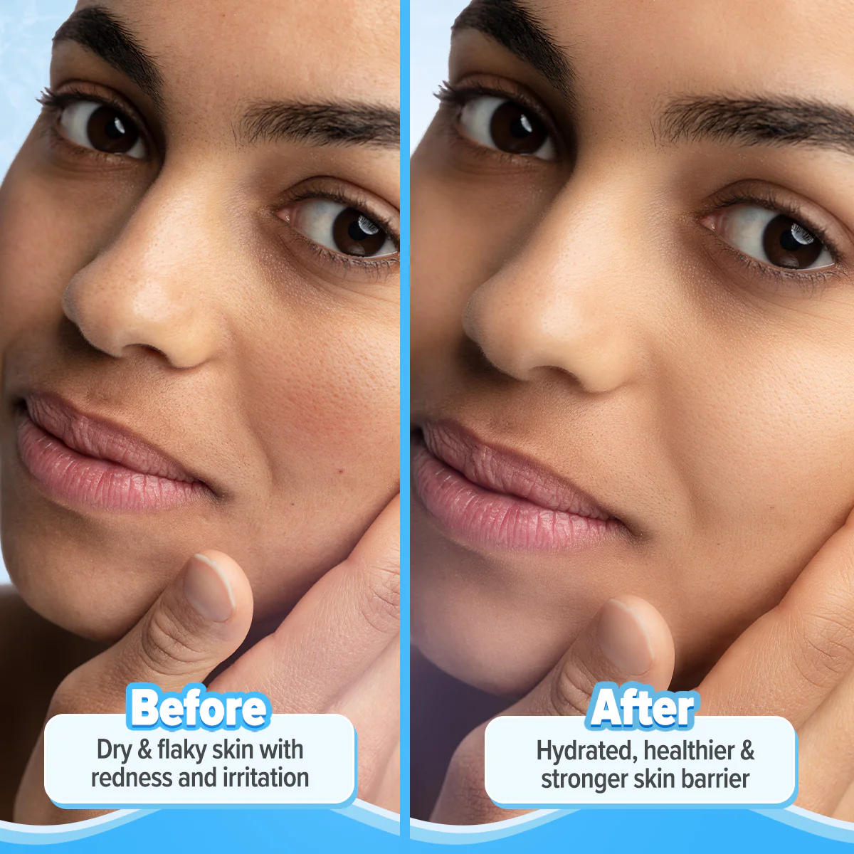 5 Barrier+ Repair Moisturizer(100 gm) - Pack of 2 - Image 6