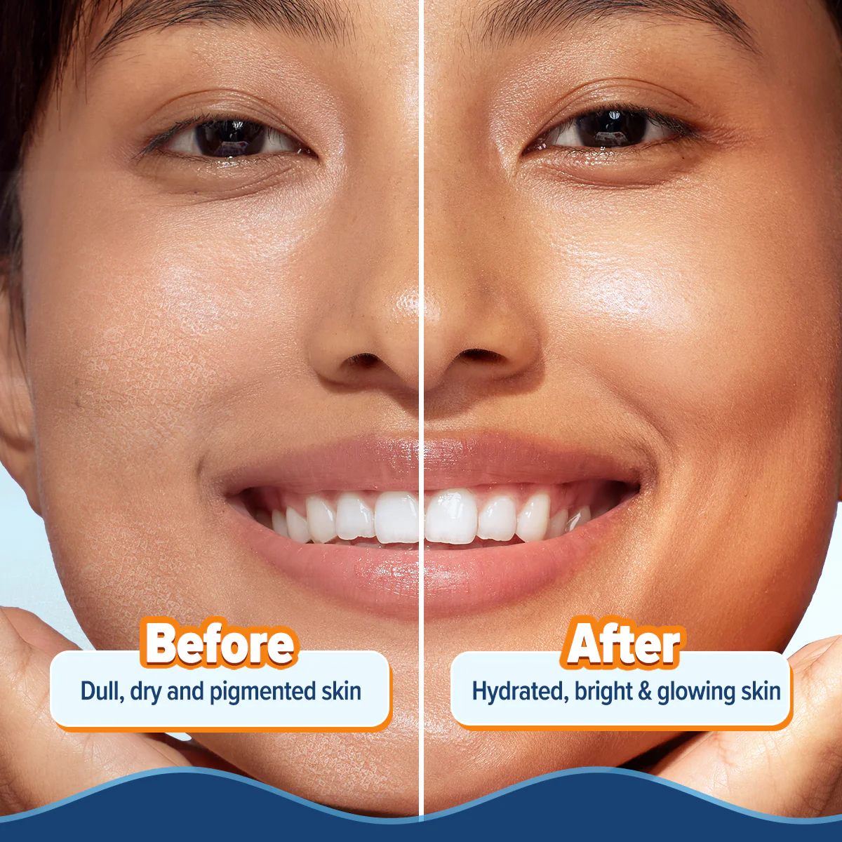 Glow+ Hydra Gel Moisturizer with Vitamin C & Papaya - 100 g - Image 8